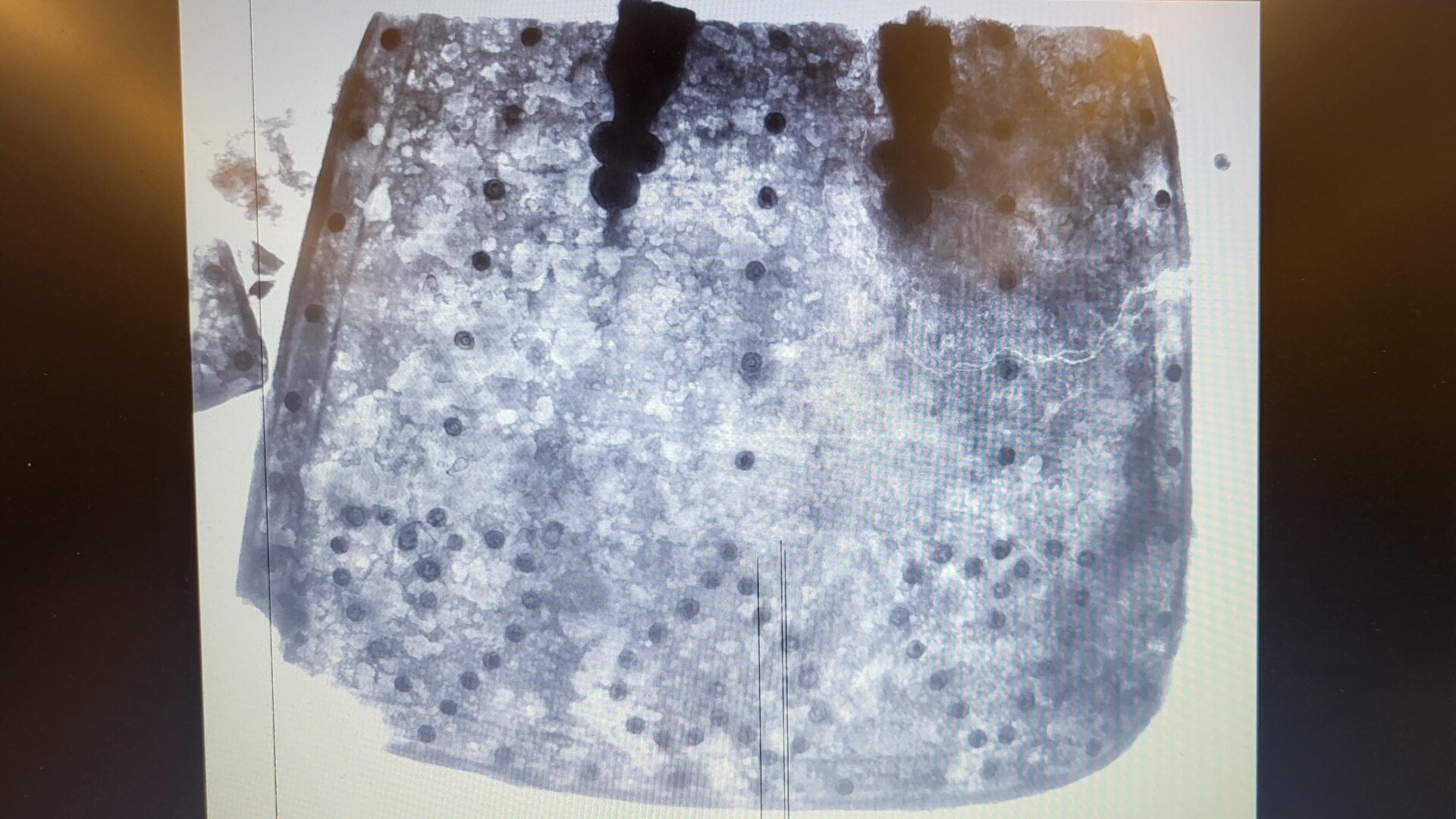 Ein Röntgenbild der Tasse zeigte einige dekorative Metallarbeiten.