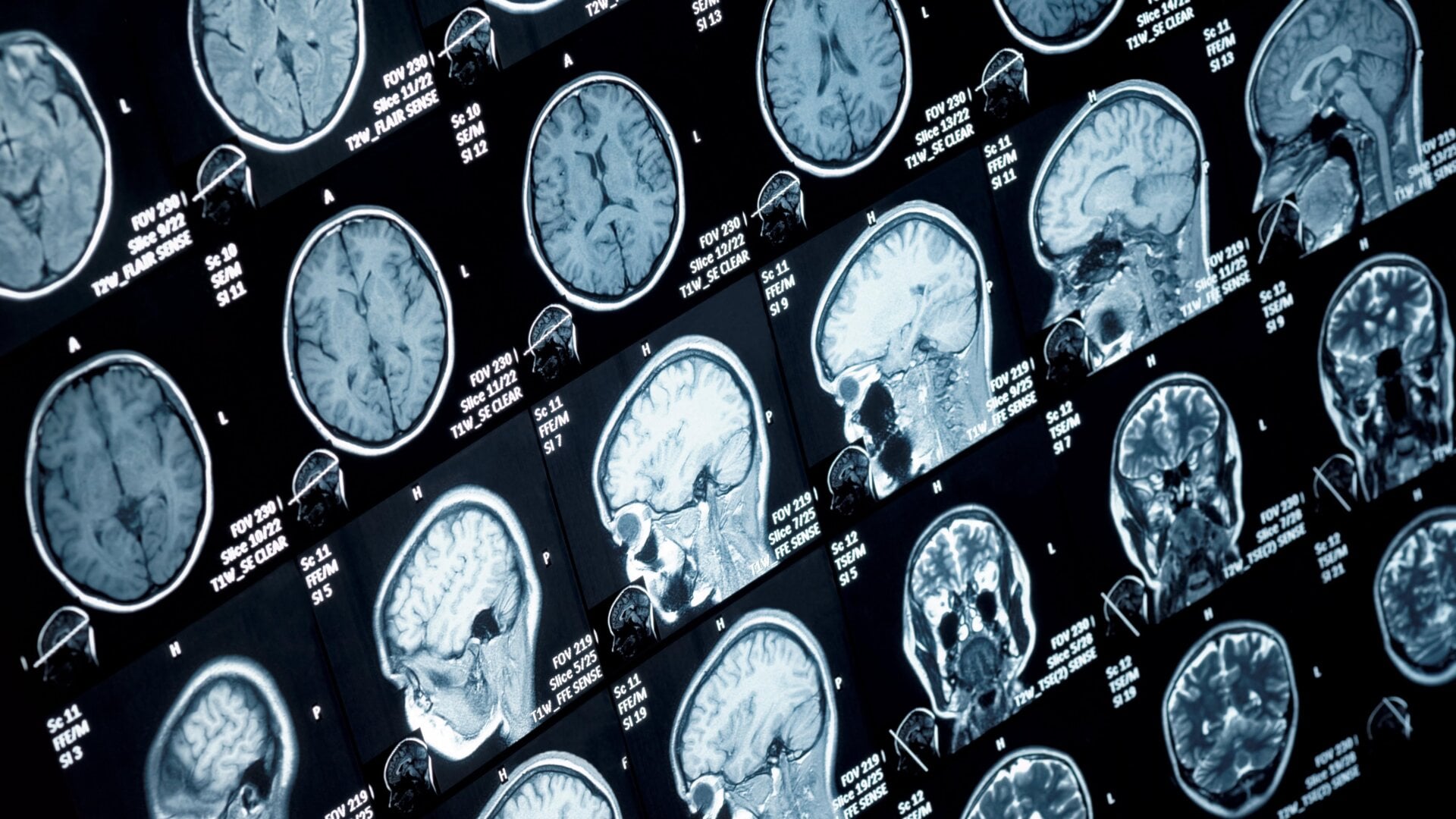 Kopf-Hals-MRT-Scans.