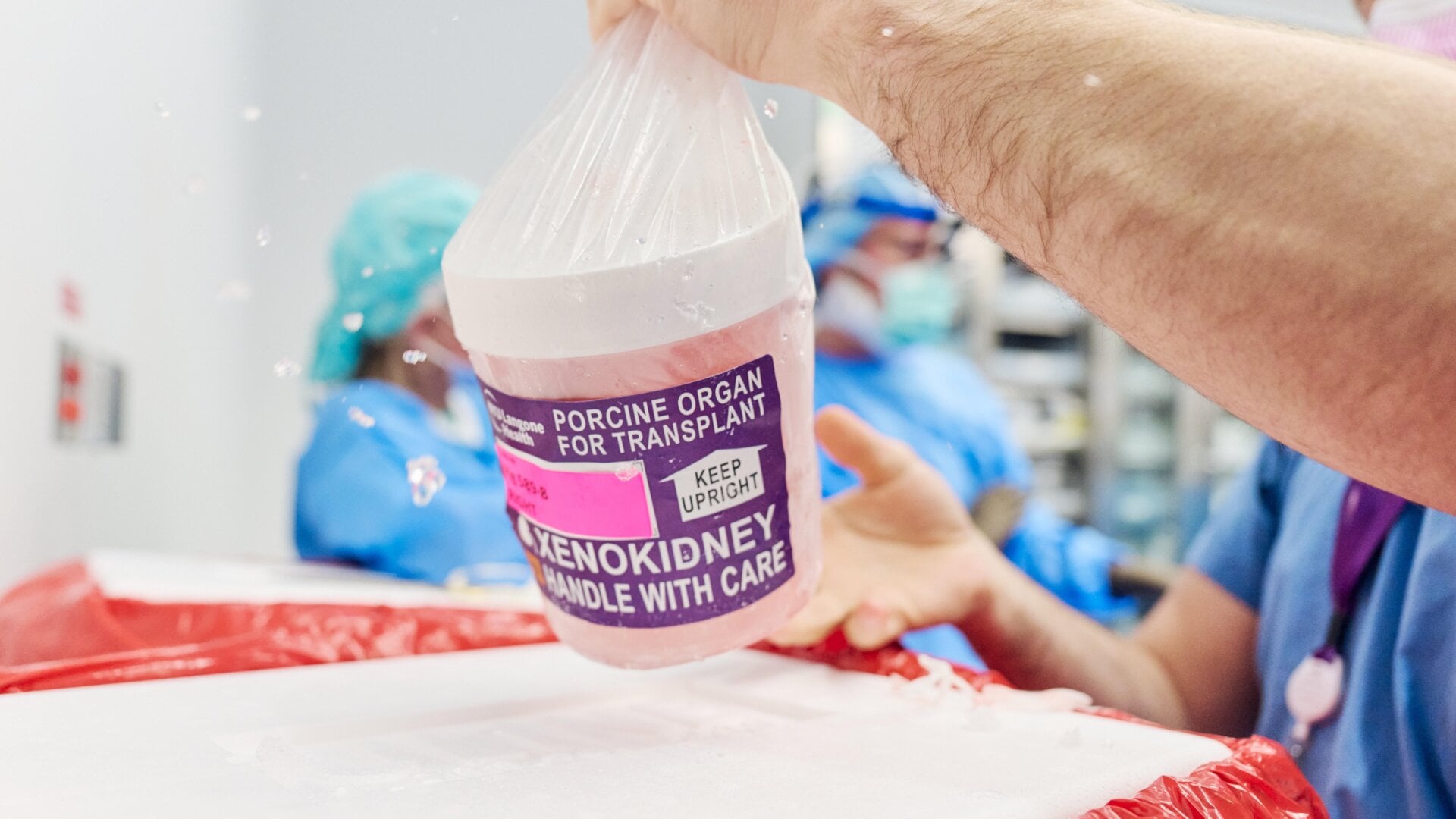 Die geneditierte Schweineniere mit Thymus wird aus ihrem Transportbehälter entnommen, um für die Transplantation vorbereitet zu werden.