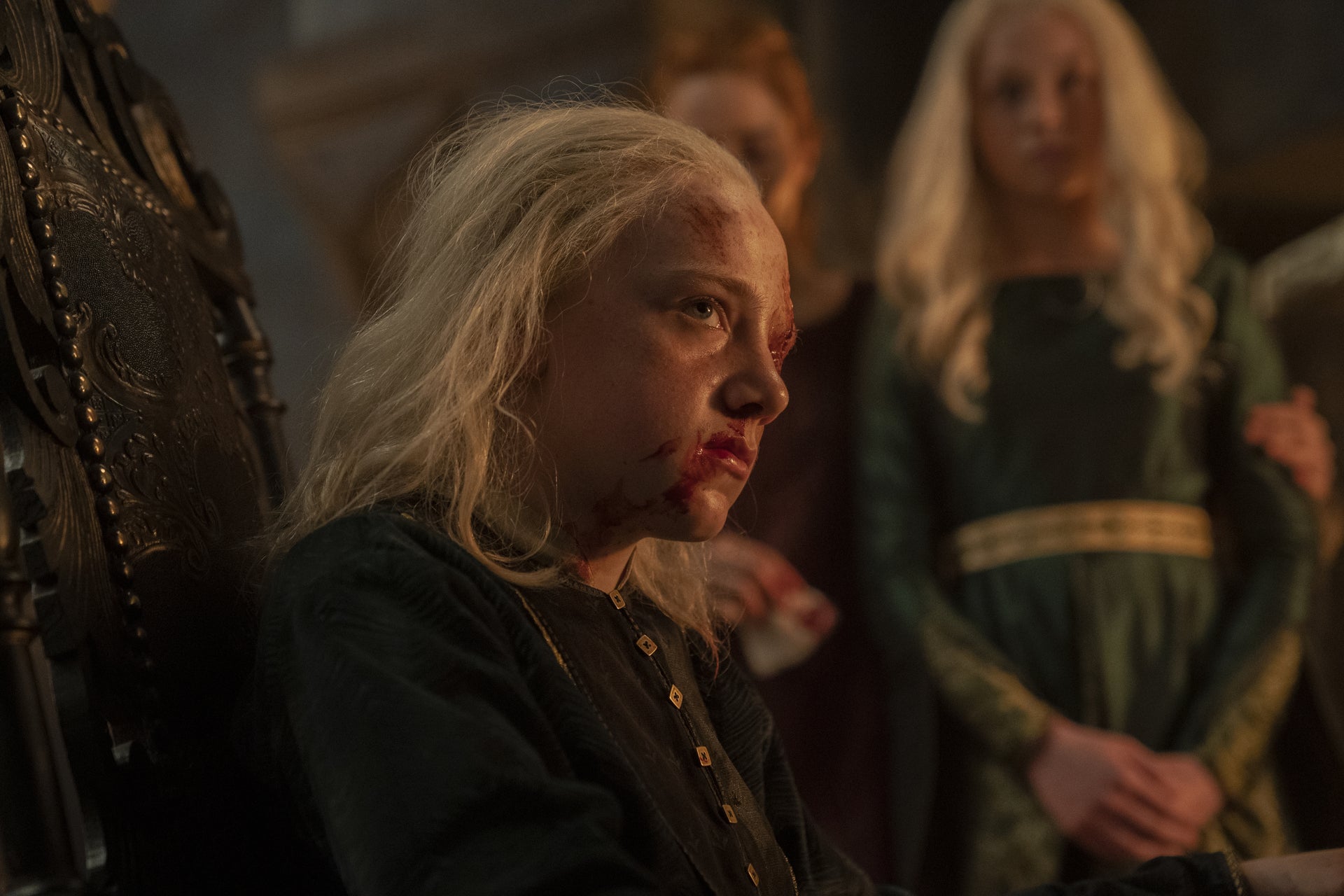 Young Aemond (Leo Ashton) 