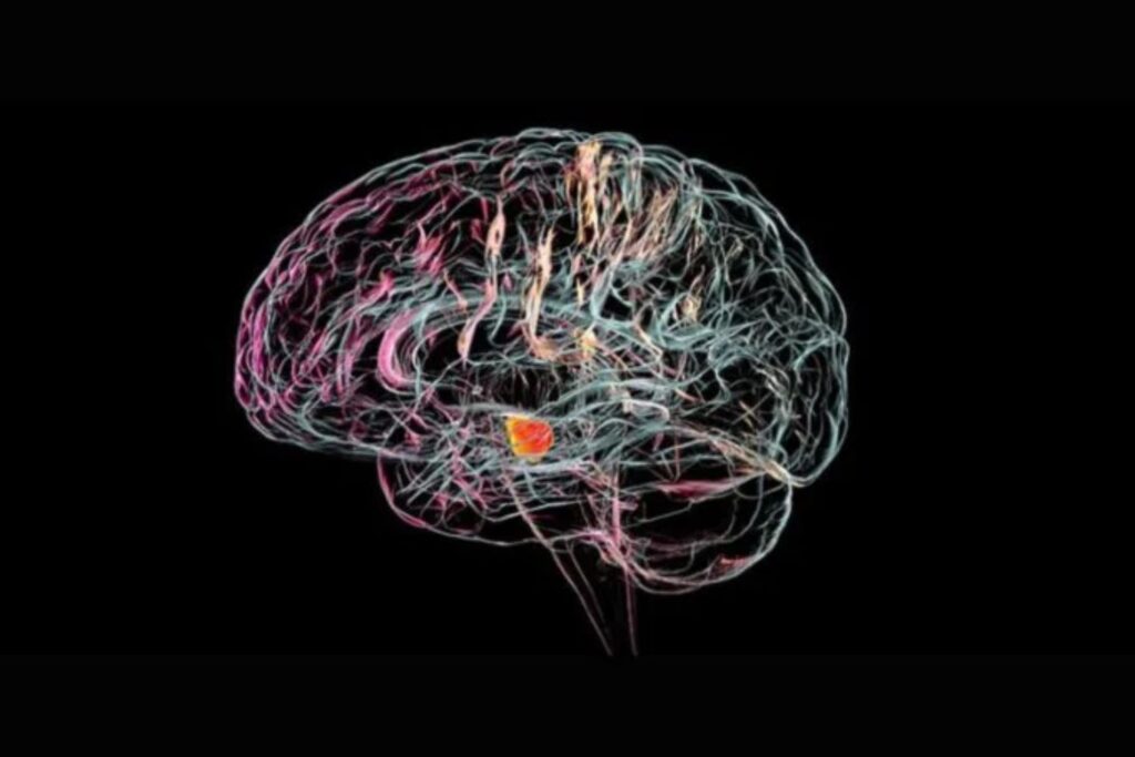 An artist's rendering of the future brain implant.