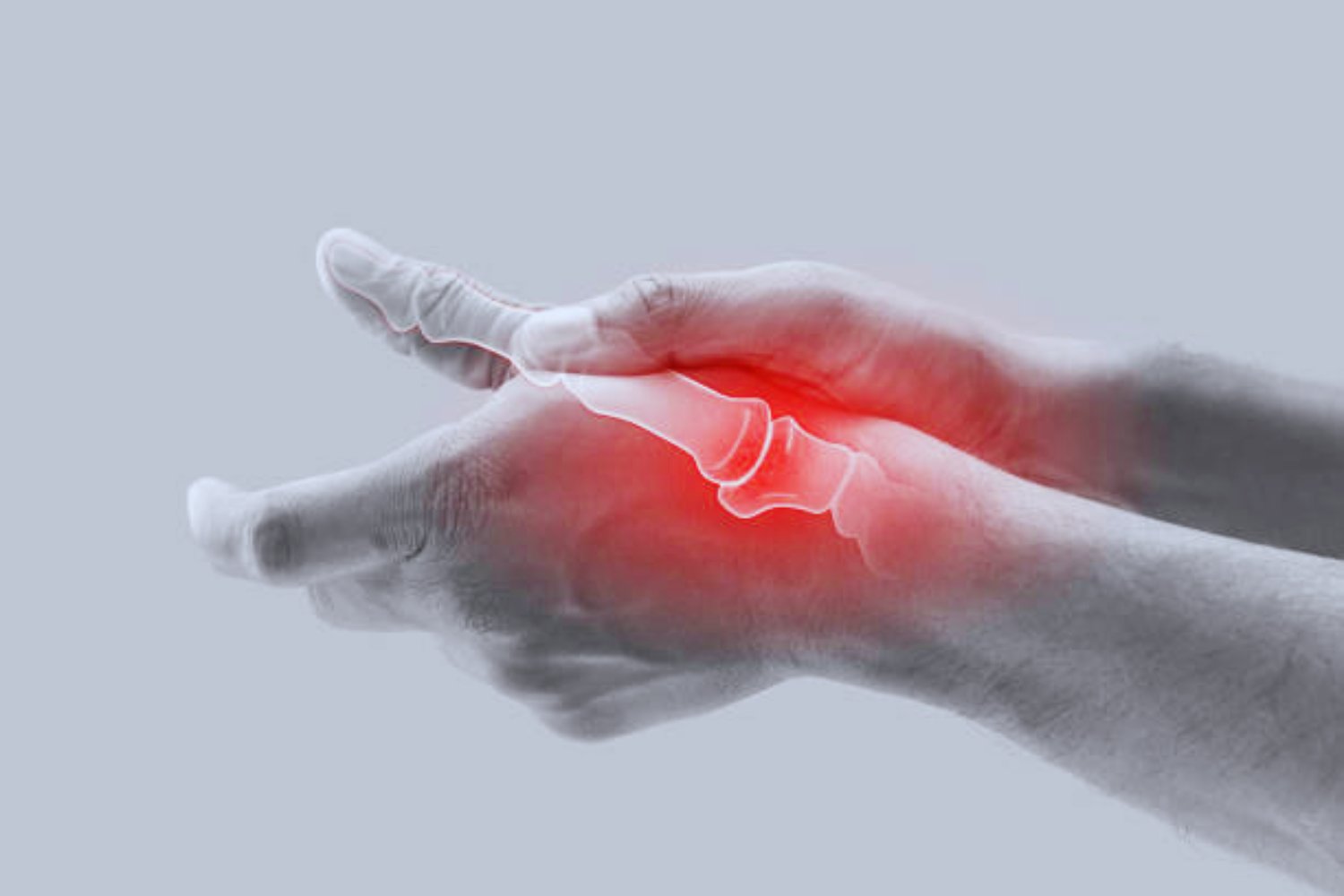 Diese beliebten Lebensmittel können Arthrose verschlimmern – was Sie jetzt wissen sollten