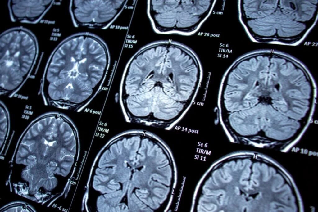 Brain Data 1