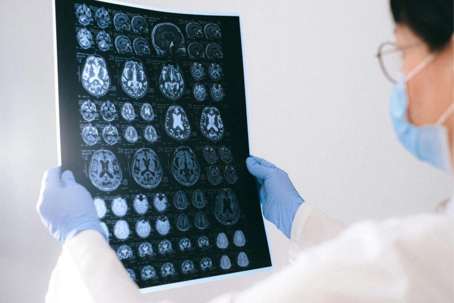 Eine einfache Blutprobe, die alles verändern könnte: Der Fortschritt, der die Alzheimer-Diagnose revolutioniert
