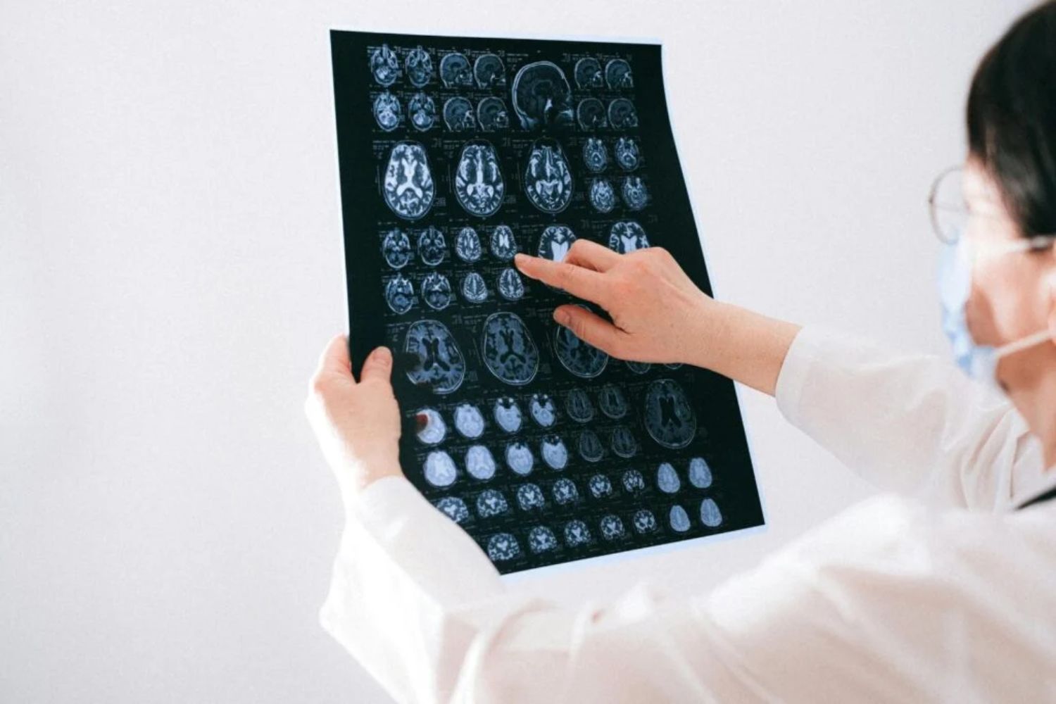 Ein neuer Blick auf das verletzte Gehirn: Die Methode, die traumatische Diagnosen revolutionieren könnte