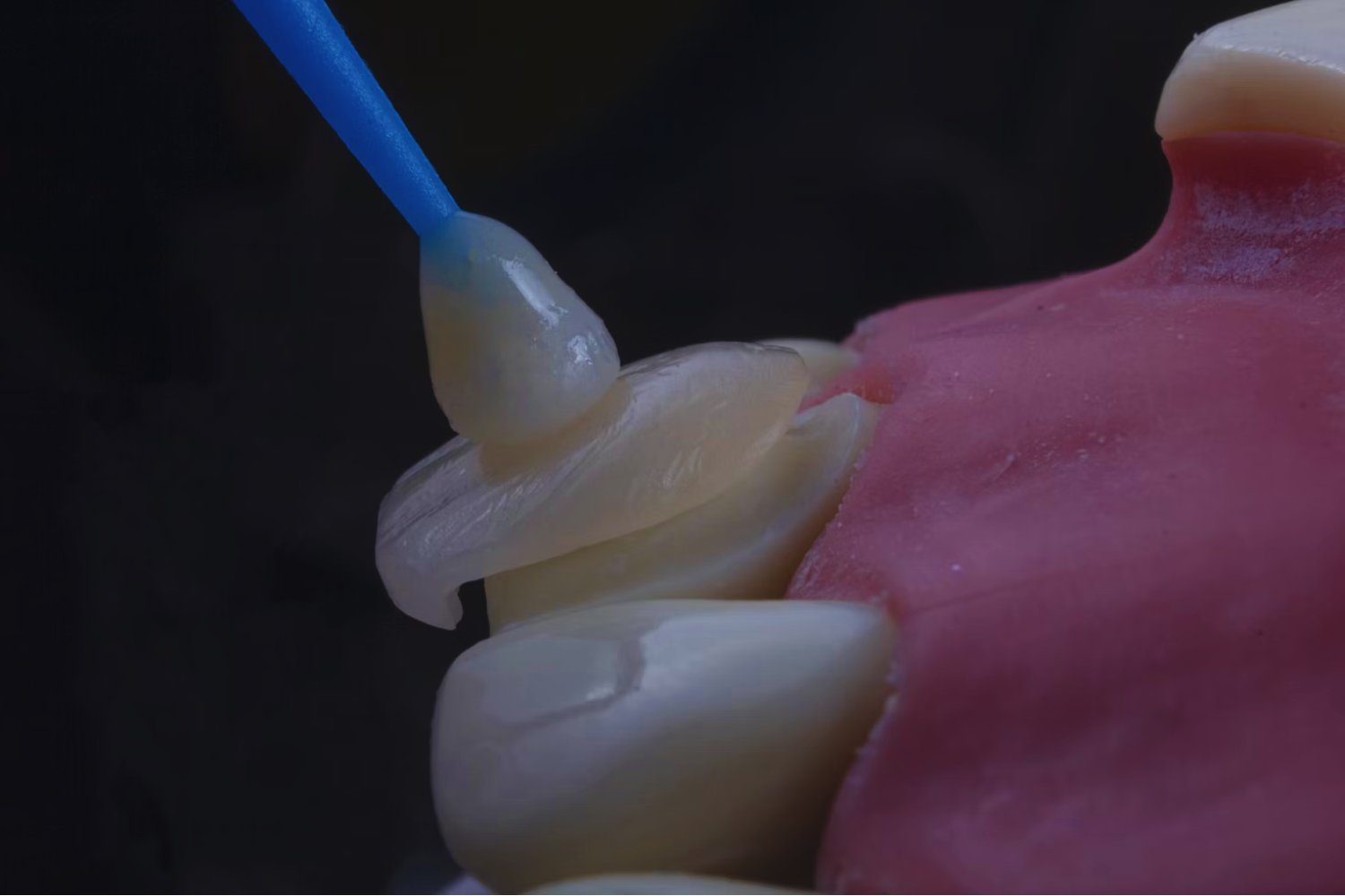 DTeure Abzocke oder echte Vorsorge? Was wirklich hinter der professionellen Zahnreinigung steckt